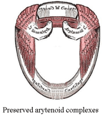 afhns clinical practice guidelines supraglottic cancer